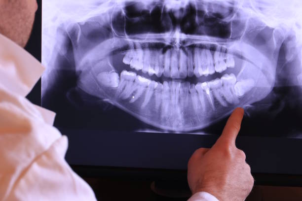 Best Emergency Tooth Extraction in Citrus Park, FL